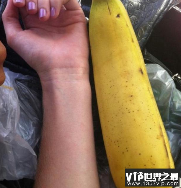 世界上最大的巨型香蕉 有什么药用价值？