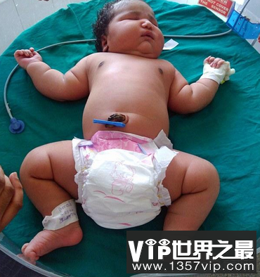 印度19岁的母亲,世界上最大的女婴,生下了13.6斤的女婴(新生儿)