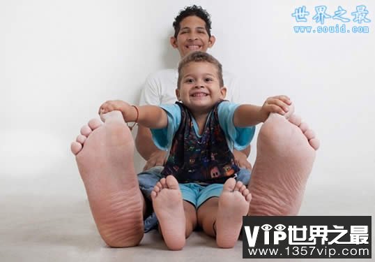 世界上最大的脚，长达0.4米(比小孩还高)(www.5300tv.com)