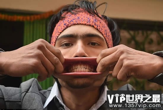 最新世界第一大嘴，尼泊尔男子嘴巴插进138支铅笔(www.5300tv.com)