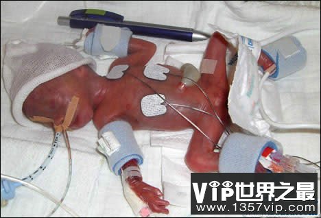 世界上最大的婴儿，出生既37斤(等同于6岁孩子体重)(www.5300tv.com)