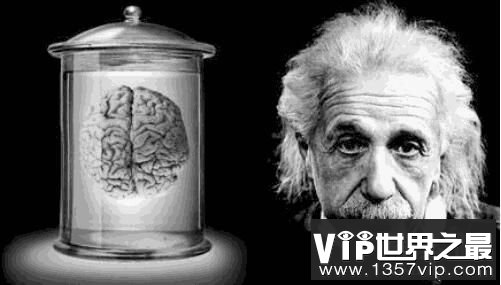 爱因斯坦出生时脑袋畸形，大脑比普通人的大脑小