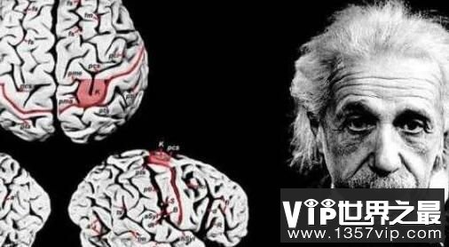 爱因斯坦出生时脑袋畸形，大脑比普通人的大脑小