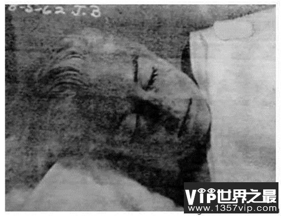 【玛丽莲梦露没牙齿原因是什么】玛丽莲梦露死亡真相是自杀还是他杀?