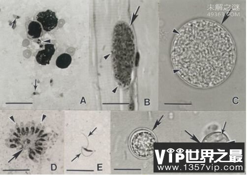 现实存在的恐怖僵尸案例 河豚毒素可让人变成僵尸