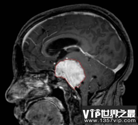 人类粪便转化为火箭燃料，细菌12项惊人的发现