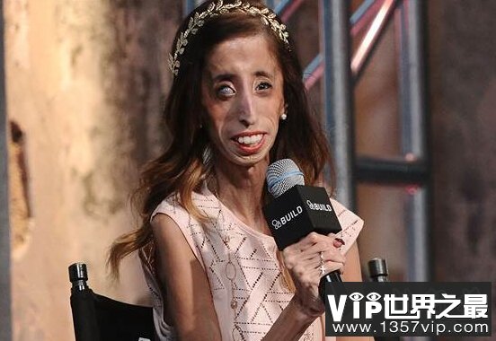 世界上最丑的女人：利兹·维拉斯奎兹