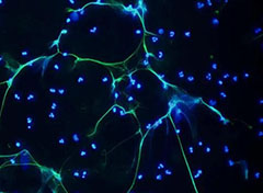 中性粒细胞，人类身体内的微型84消毒液工厂