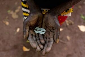 非洲割礼指的是什么，一种割除生殖器的仪式(男割包皮/女割阴蒂)