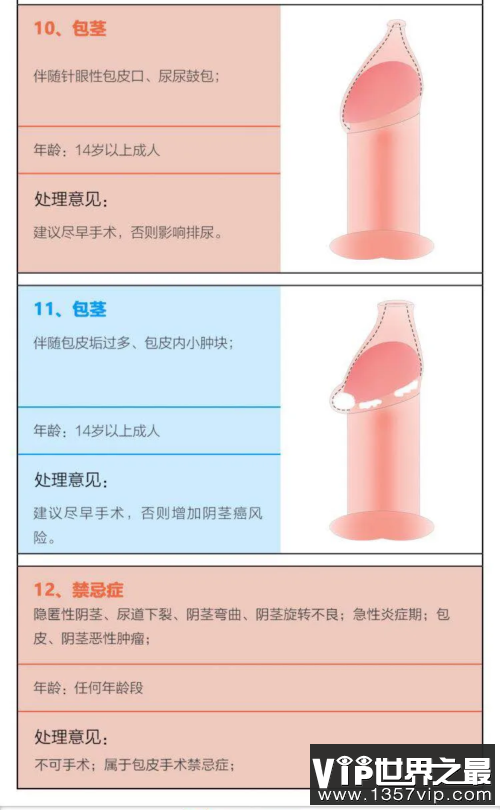 如何判断包皮是否过长