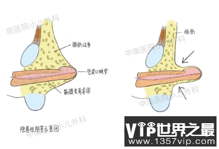 丁丁包裹住而不能显露