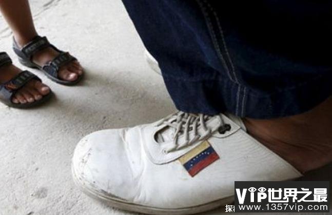 世界上脚最大的人 来自委内瑞拉20岁年轻小伙(长达40.5厘米)