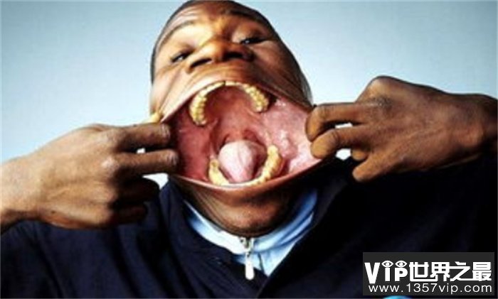 世界上嘴巴最大的人 宽度有17cm（最大嘴巴）