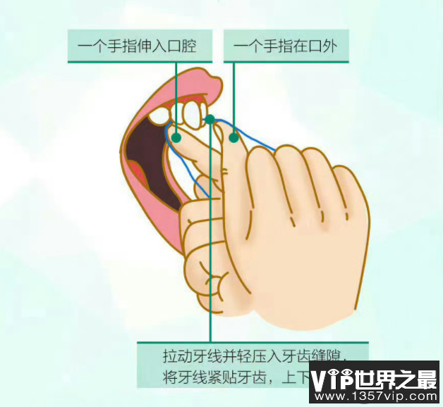 经常用牙线会让牙缝变宽吗 牙线和牙签哪个更好