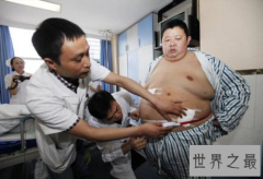 中国第一胖孙亮，体重高达600相当于4个成年人